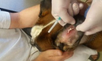 Отогематома ушной раковины