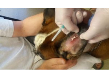 Отогематома ушной раковины